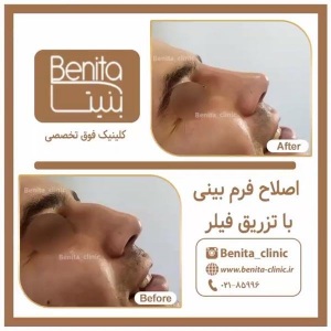 تزریق-ژل50