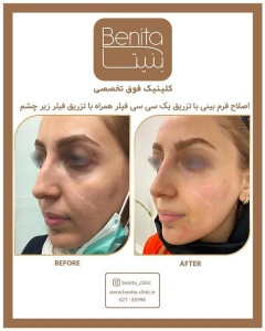 تزریق-ژل63