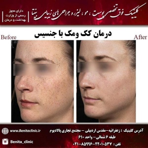 جوانسازی-2