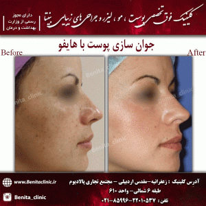 هایفوتراپی-8
