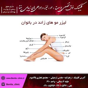 لیزر مو