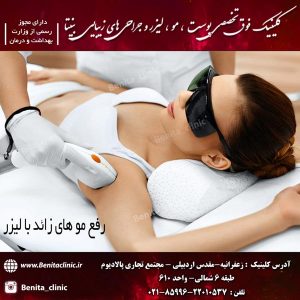 رفع مو های زائد با لیزر