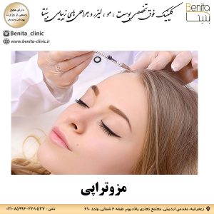 مزوتراپی