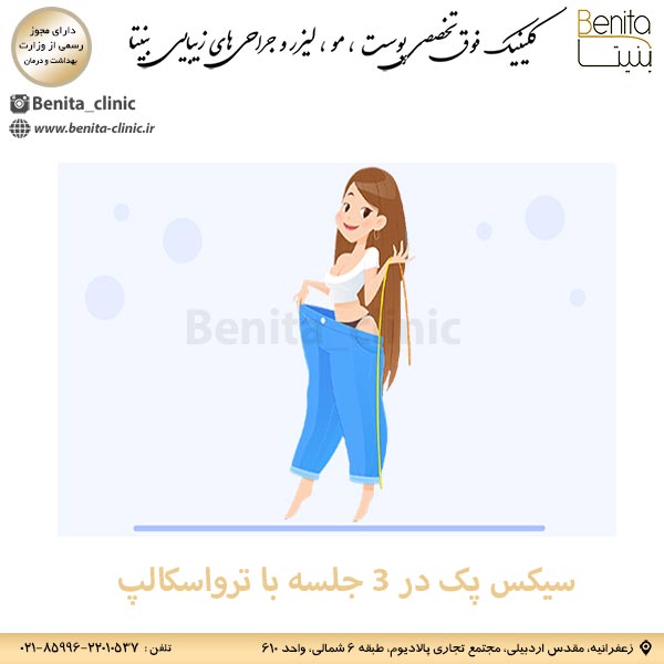 ترواسکالپ