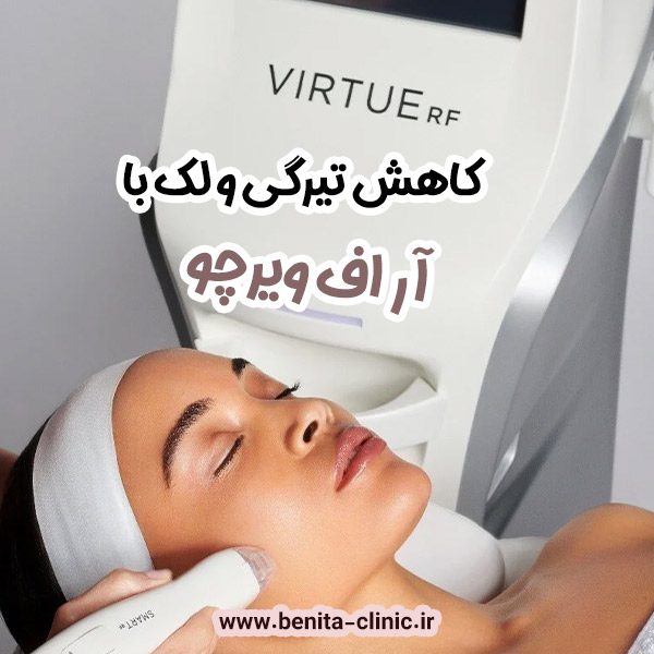 کاهش تیرگی و لک‌ها با آر اف ویرچو - کلینیک بنیتا