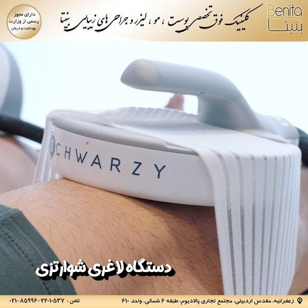 دستگاه شوارتزی - کلینیک بنیتا https://benita-clinic.ir/