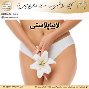 لابیاپلاستی benita -clinic.ir