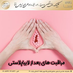 مراقبت‌ های بعد از لابیاپلاستی benita -clinic.ir