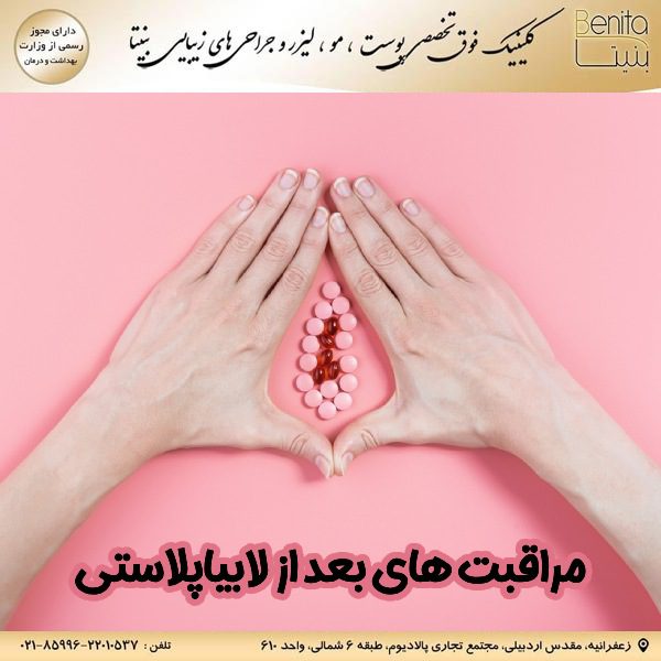 مراقبت‌ های بعد از لابیاپلاستی benita -clinic.ir