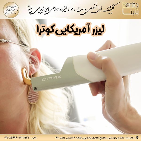 لیزر آمریکایی کوترا - کلینیک فوق تخصصی بنیتا