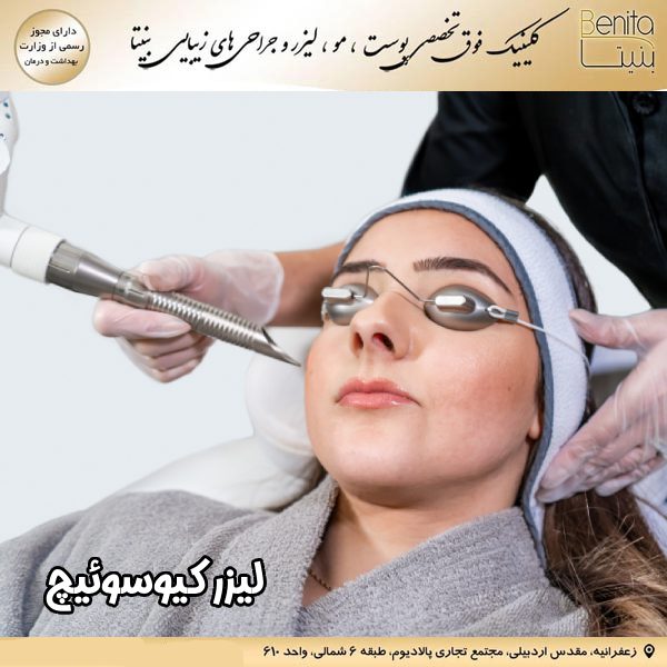 لیزر کیوسوئیچ - کلینیک بنیتا https://benita-clinic.ir/