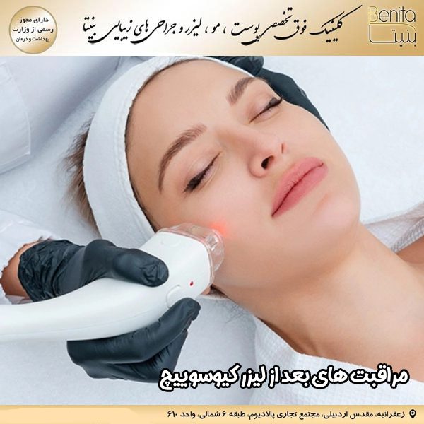 مراقبت‌ های بعد از لیزر کیوسوییچ - کلینیک بنیتا https://benita-clinic.ir/