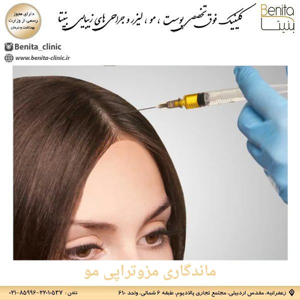 ماندگاری مزوتراپی مو _ کلینیک بنیتا